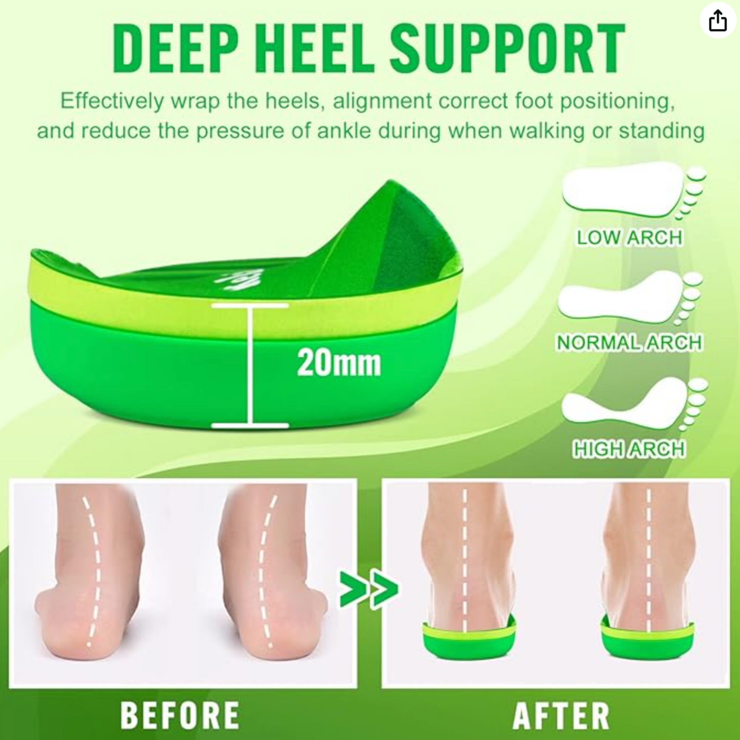 Unisex Adult Orthodontic Arch Support Shoe Insoles